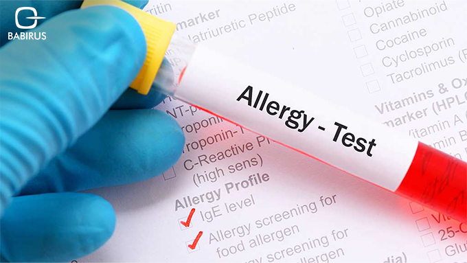 The Science Behind Allergy Testing: How It Works and Why It Matters 